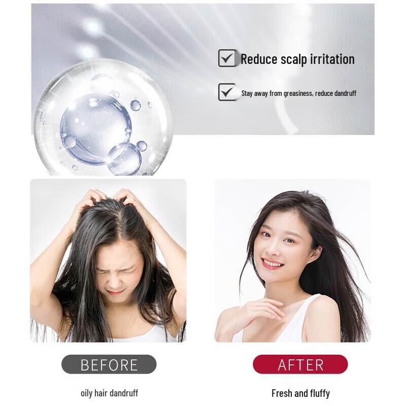 ShuLei PRO Oily Scalp Oil Control Anti-Dandruff Shampoo