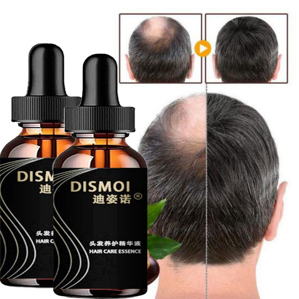 Anti-Alopezie-Haarwachstumsserum, ätherisches Öl, Anti-Haarausfall-Spray-Produkte, Ingwer-Behandlung, trockenes, krauses, beschädigtes Haar