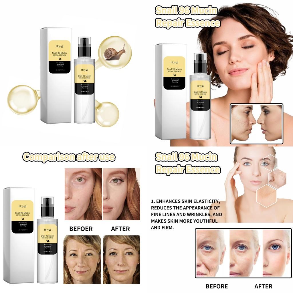 Hoygi Snail Collagen Essence Serum For Youthful Skin Hydration And Fine Line Reduction