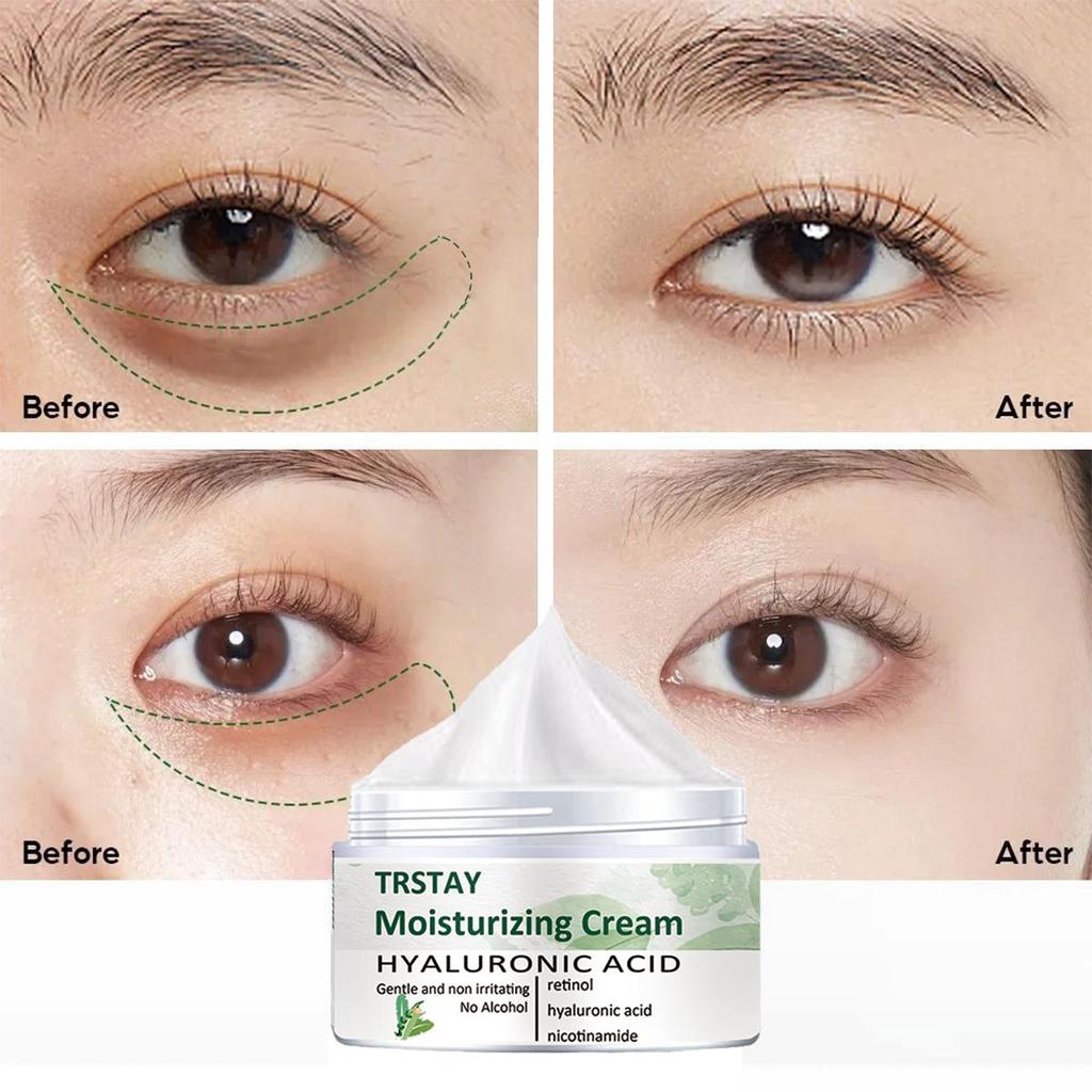 Skånsom og ikke-irriterende, Retinol Peptide Rejuvenating Moisturizing Eye Cream oppstrammer og lysner opp huden, og etterlater huden myk og raffinert