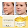 Freckle Removing Nevus Gel Whitening And Rejuvenating Skin Lightening Sun Freckle Brightening Skin Cream