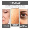 Limited time!!Eelhoe Oligopeptide Facial Essence Is A Daily Care Essence That Deeply Hydrates, Moisturizes And Tightens The Facial Skin