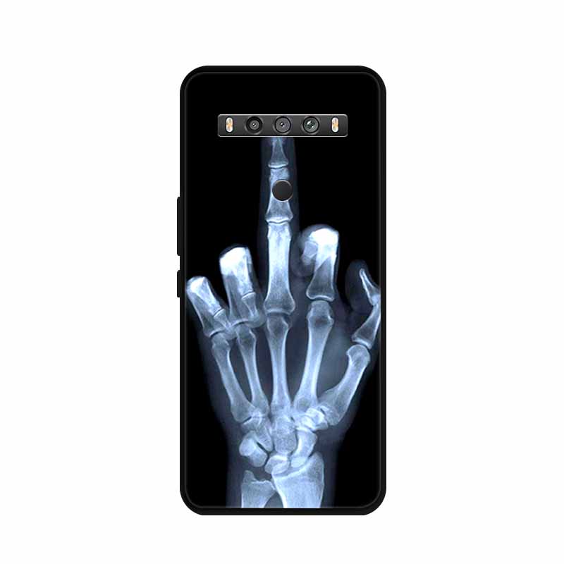 For TCL 10 5G UW Case Animals Silicone TPU Soft Cover Phone Coque For TCL 10 SE TCL10 5G UW Capa Shockproof Cartoon Wolf Funda