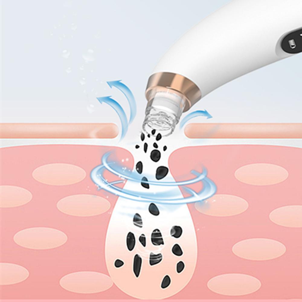 1PC Blackhead Remover Facial Pore Cleaner Water Circulation Portable Vacuum Tool