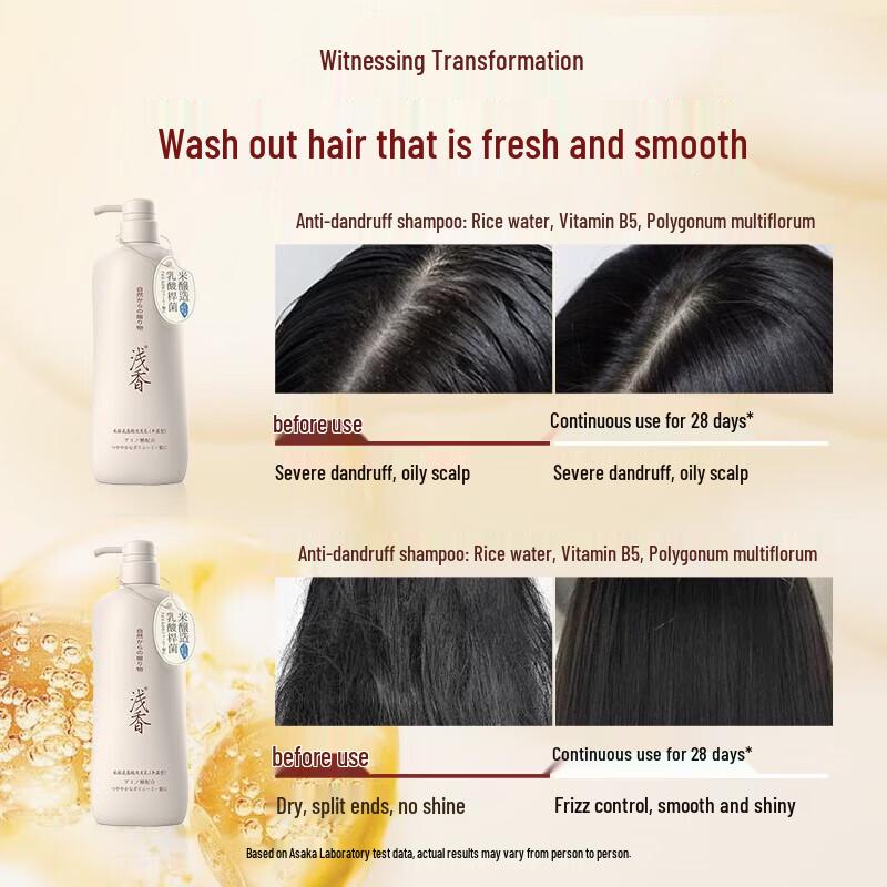Qianxiang Anti-Dandruff Scalp Care Shampoo