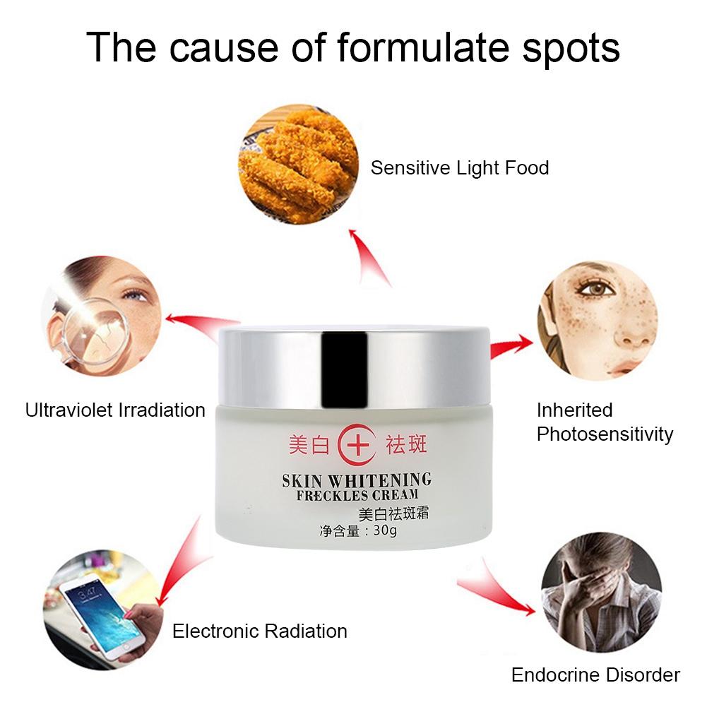 30g Anti Melasma Facial Whitening Brightening Cream Dark Spots Freckle Removal