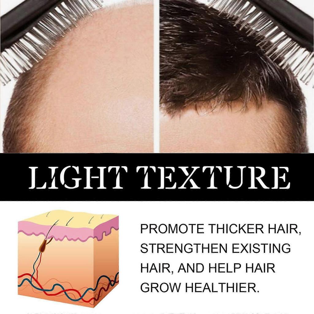 2025 Latest Model  Rosemary Hair Care Essential Oil, Repair Dry Hair, Moistening