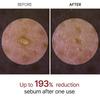 Exfoliating White Rice Essence Facial Barrier Repair Black Rice Extract Gentle Renewal Brightening Hydrating Serum 