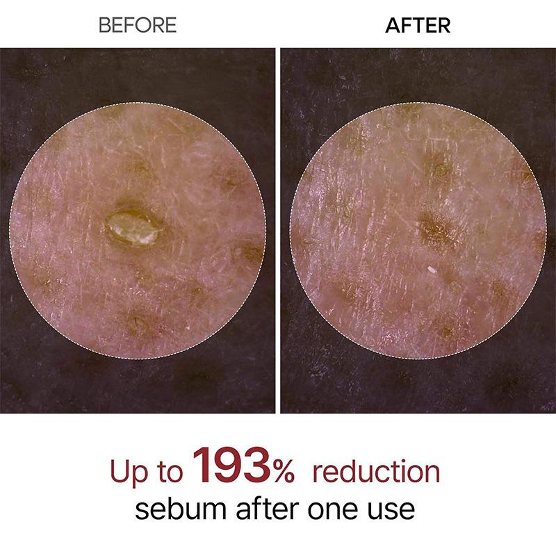 Exfoliating White Rice Essence Facial Barrier Repair Black Rice Extract Gentle Renewal Brightening Hydrating Serum 