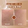    Arte [1+1 Nmn Rapid Pore Ampoule] Arte Pore Cell Programming Ampoule Duo Project Ampoule Single