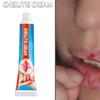 20g Cheilitis Cream for Dry Chapped Cracked Peeling and Bleeding