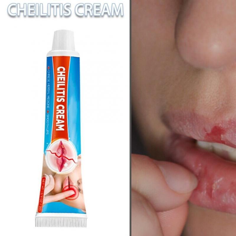 20g Cheilitis Cream for Dry Chapped Cracked Peeling and Bleeding