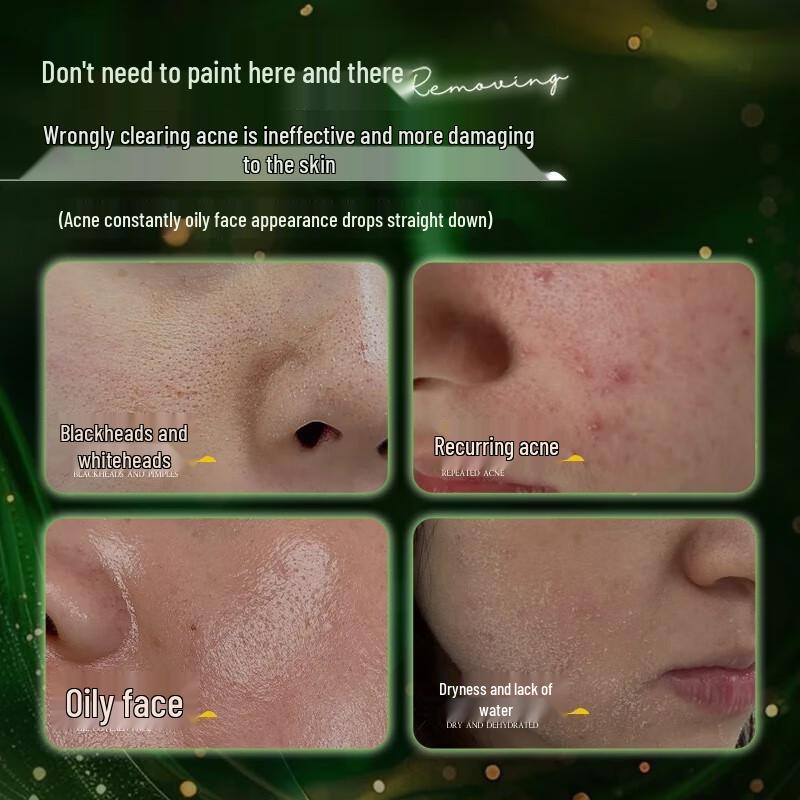 Zhiqu Salicylsäure Akne-Reparaturserum