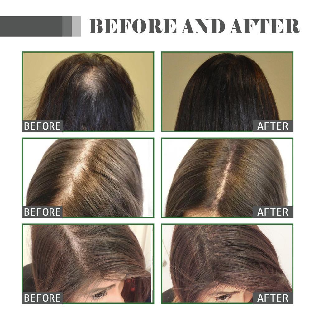 Hoegoa Nourishing Hair Oil For Damaged And Dry Hair Promoting Healthy Softness 35ml