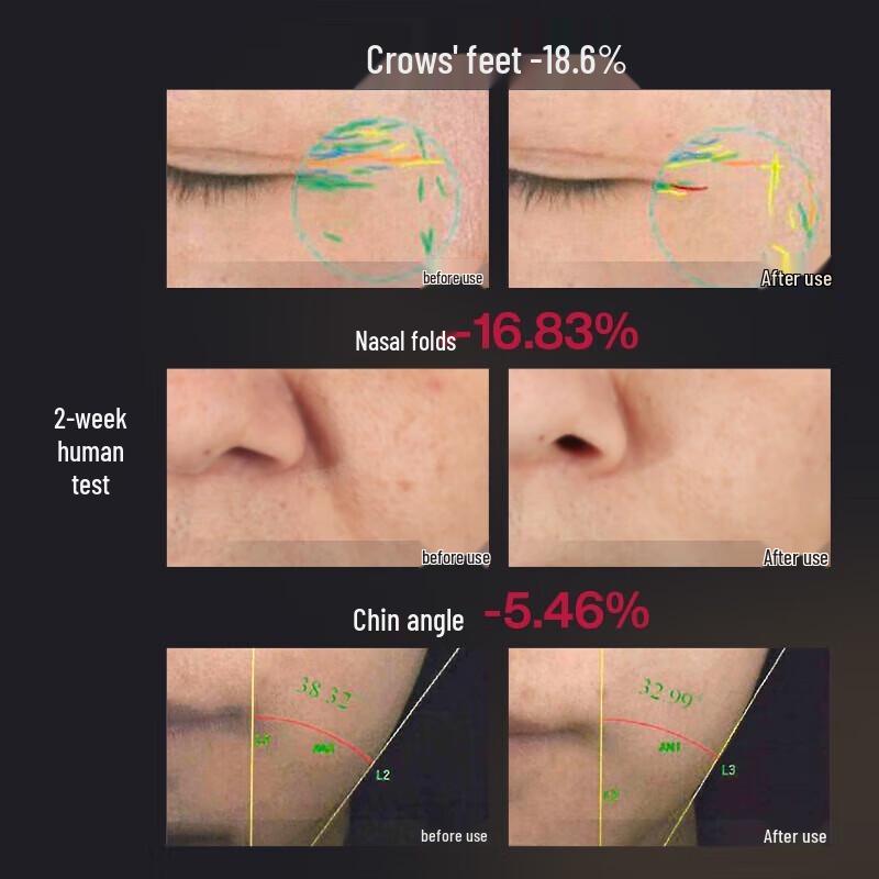 AMIRO R1 PRO Facial Anti-Aging and Firming Device