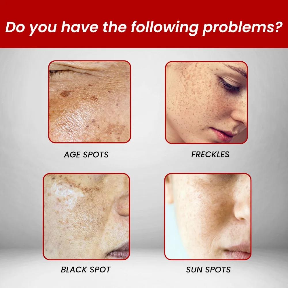 A Hydrating Moisturizing Cream To Make It Look Smoother and Less Wrinkled, an Essential Part of Your Daily Facial