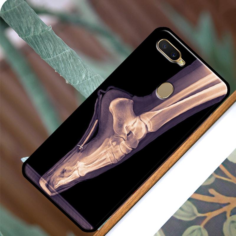 Etui na telefon z rentgenowską anatomią człowieka dla OPPO A15 A3S A5S A52 A72 A54 A74 A94 A83 A91 A93 A5 A9 A31 A53 A53S 2020