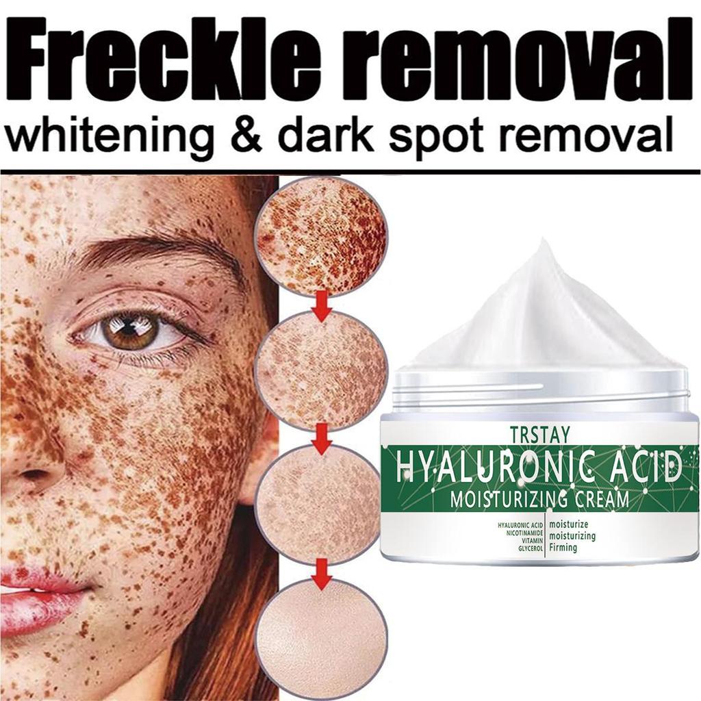 TRSTAY Vitamin C für Gesichtscreme, Pigmente, dunkle Flecken, Entfernung, aufhellende Gesichtscreme, aufhellende Hautpflegeprodukte, Schönheit, Gesundheit