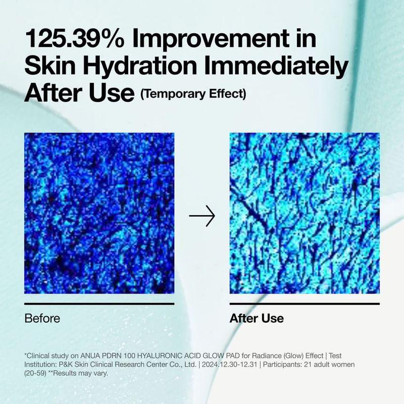 Anua PDRN 100 Hyaluronic Acid Glow Pad