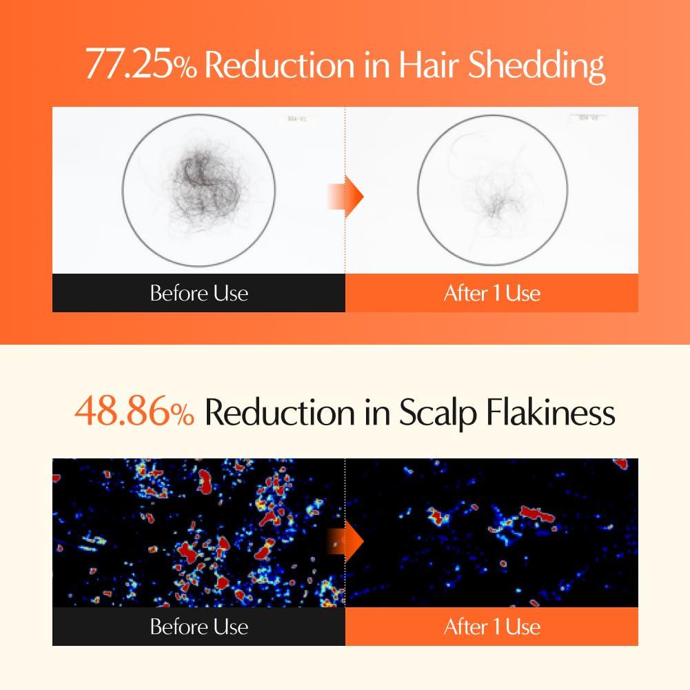 Lilyeve Grow:TURN 3D Volume Anti-Hair Loss Shampoo – 200 ml (Brush Applicator)