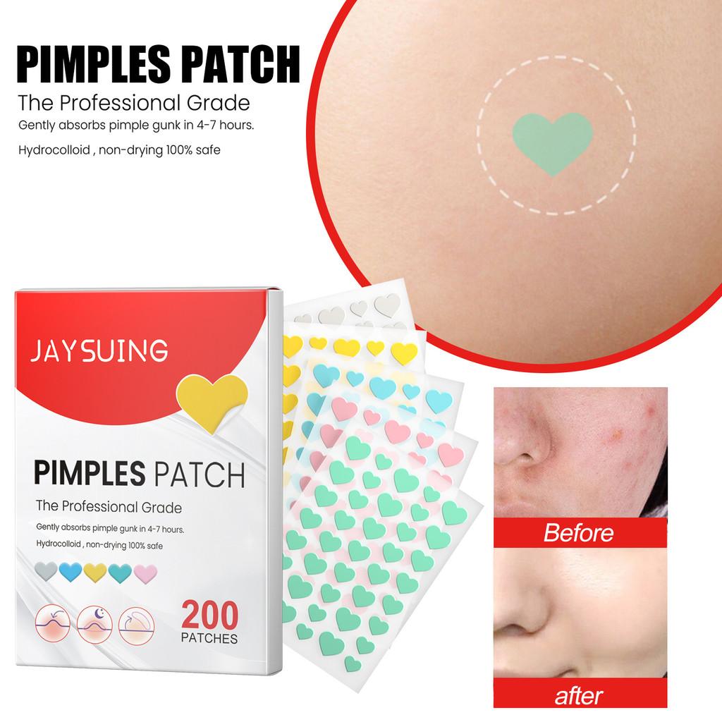 Jaysuing Love Heart Acne Patches Gentle Non Irritating Spot Treatment For Pimples