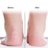 Silicone Socks Breathable Heel Protector Dry Cracking Skin