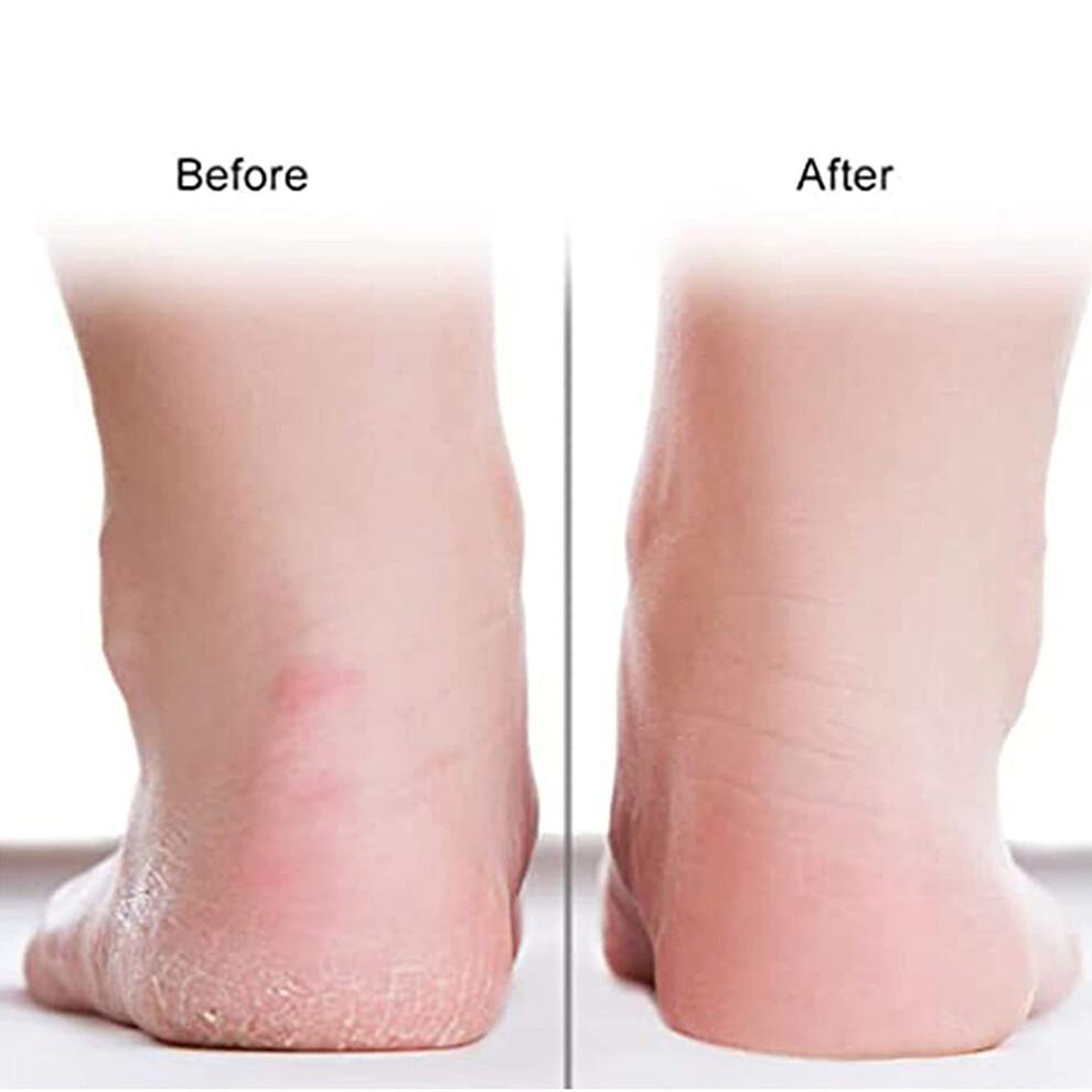 Silicone Socks Breathable Heel Protector Dry Cracking Skin