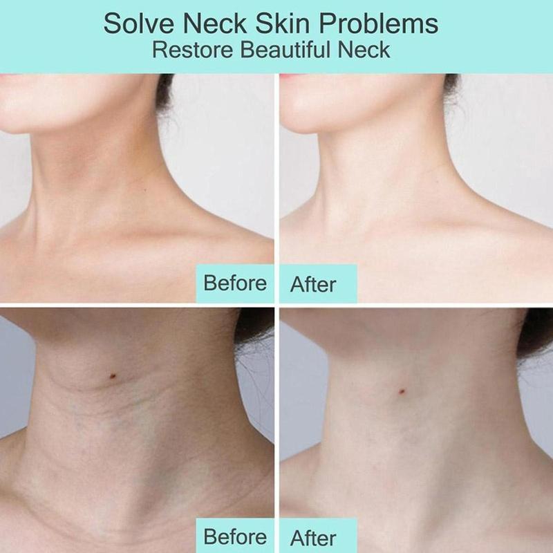 1/5/10 st Getmjölk Nackmask Kollagen Uppstramande Anti-Rynkle Whitening Anti-aging Mask Skönhet Fuktgivande Lift Uppstramande Nacke Hudvård