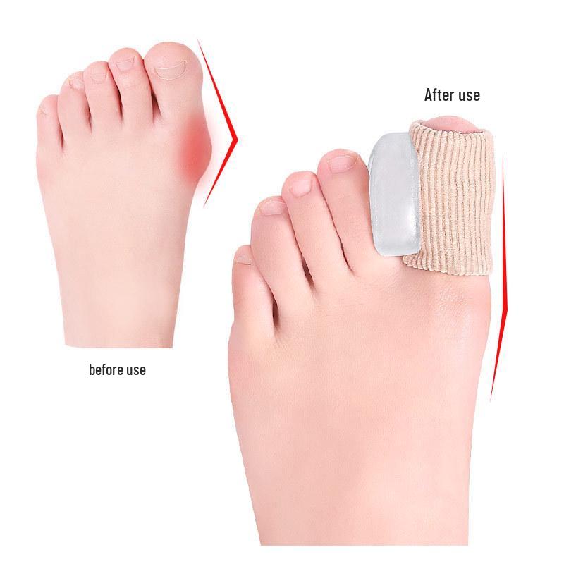 Hallux Valgus Ballenzeh Gel-Hülle zur Korrektur des großen Zehs