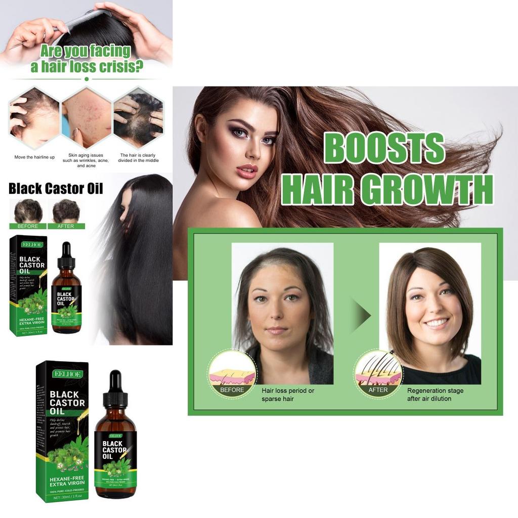 Eelhoe Castor Oil Hair Growth Serum Nourishing And Strengthening 30ml For Thicker Hair