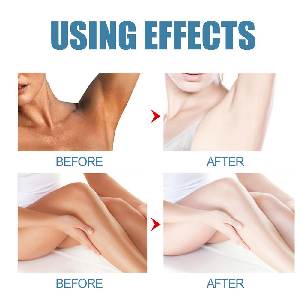 EELHOE Underarm Beauty Cream Brightening Moisturizing Body Lotion Concealer Hydrating Moisturizing Beauty Cream Underarm Cream