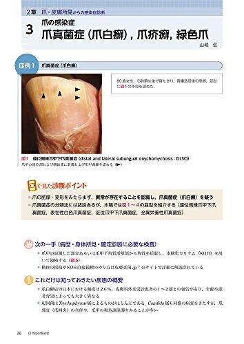 Visual Infectious Diseases: How Much Can You Diagnose by Appearance? An Atlas of Infectious Disease Images