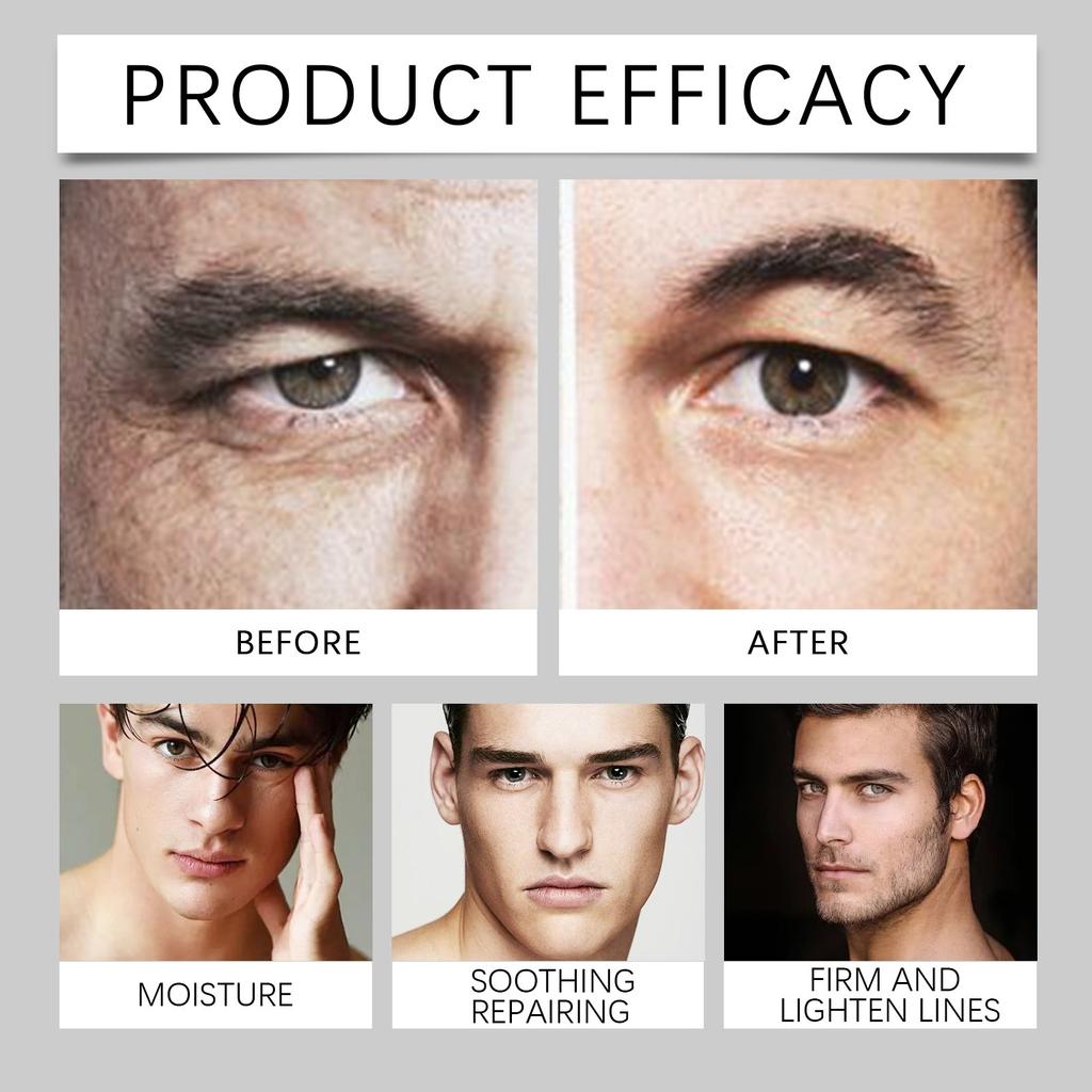 Eye Anti-wrinkle Moisturizing Hydrates, Moisturizes, Tightens And Reduces Fine Lines Around The Eyes10ml