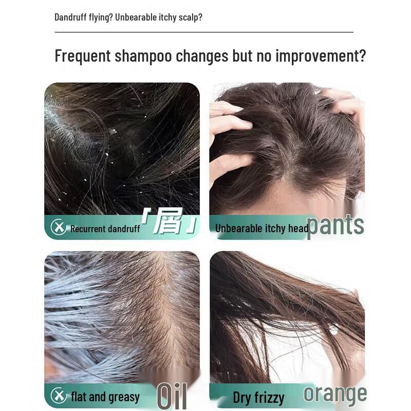 ShuLei Dynamic Dandruff Control Shampoo