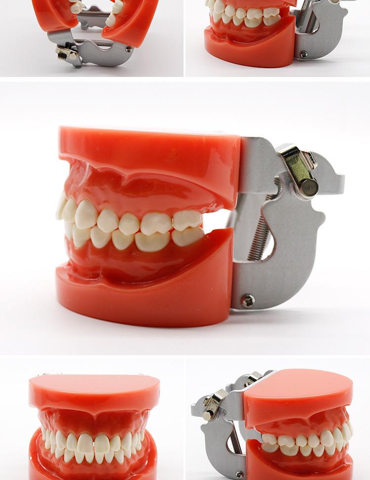 Dental Educational and Communication Model Set: Comprehensive, Removable, and Implant Restoration Models