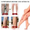 100ml  Repair Earthworm Legs Relieve Sore Legs Leg Massage Treatment Spray