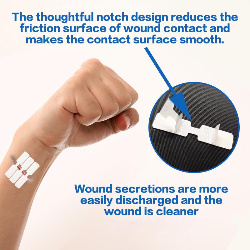 

10 шт. Пластырь на молнии Безболезненное устройство для закрытия ран Бесшовные повязки для ран Застежка-молния Редуктор швов Пластырь Onesize