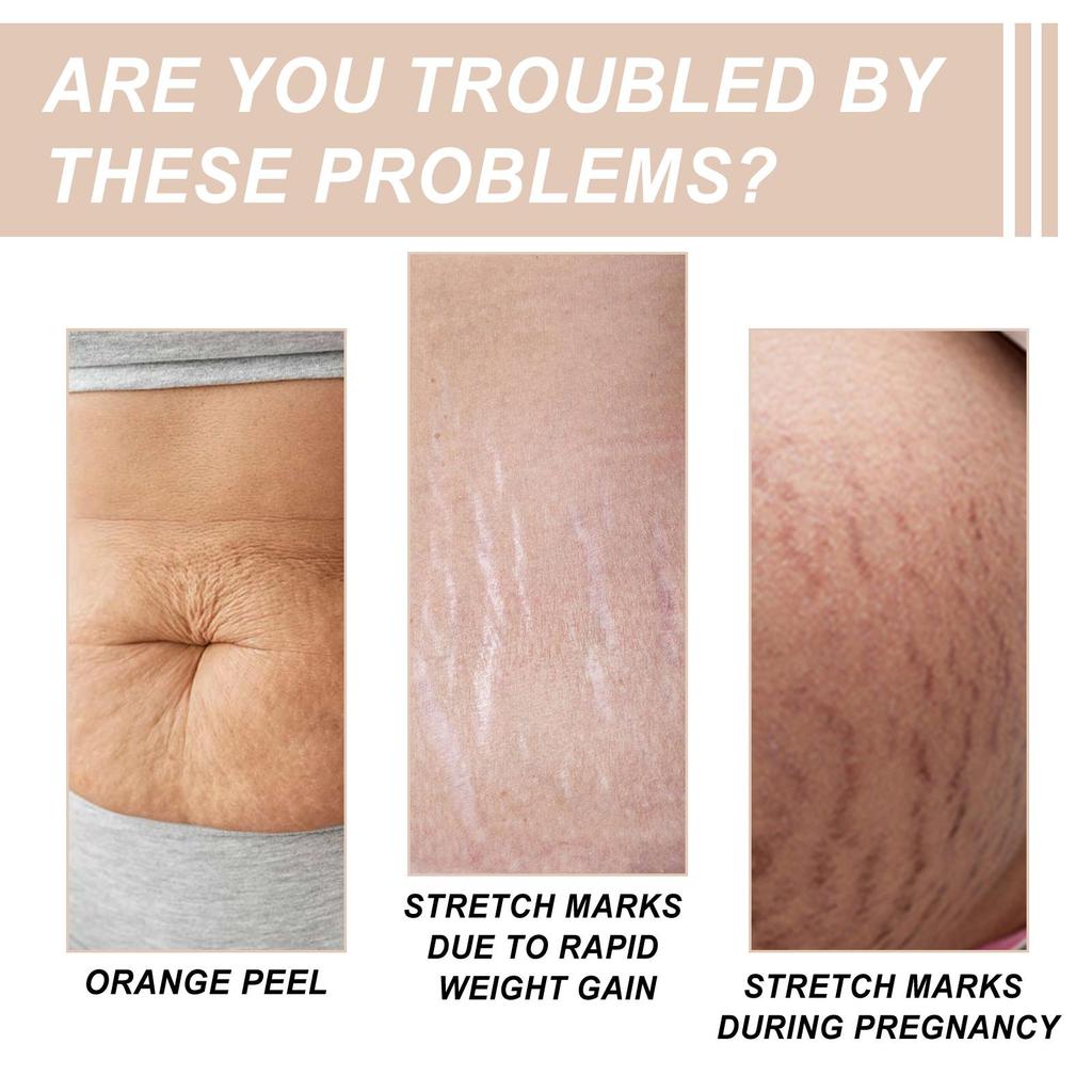 Wiieey Butter Moisturizing Cream Lightens Stretch Marks Repairs Skin Elasticity Firms & Smoothes