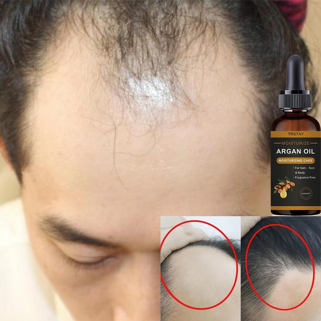 Sérum pro péči o vlasy ve spreji proti vypadávání vlasů se zázvorem pro muže a ženy