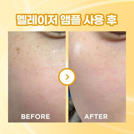 1+1 Spot Whitening Ampoule Athe Melaiser Programming Ampoule Duo Planning/Single Product