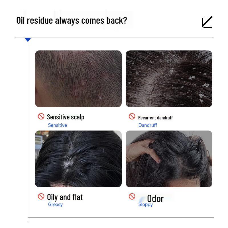 MANTING Amino Acid Oil Control Anti-Dandruff Shampoo