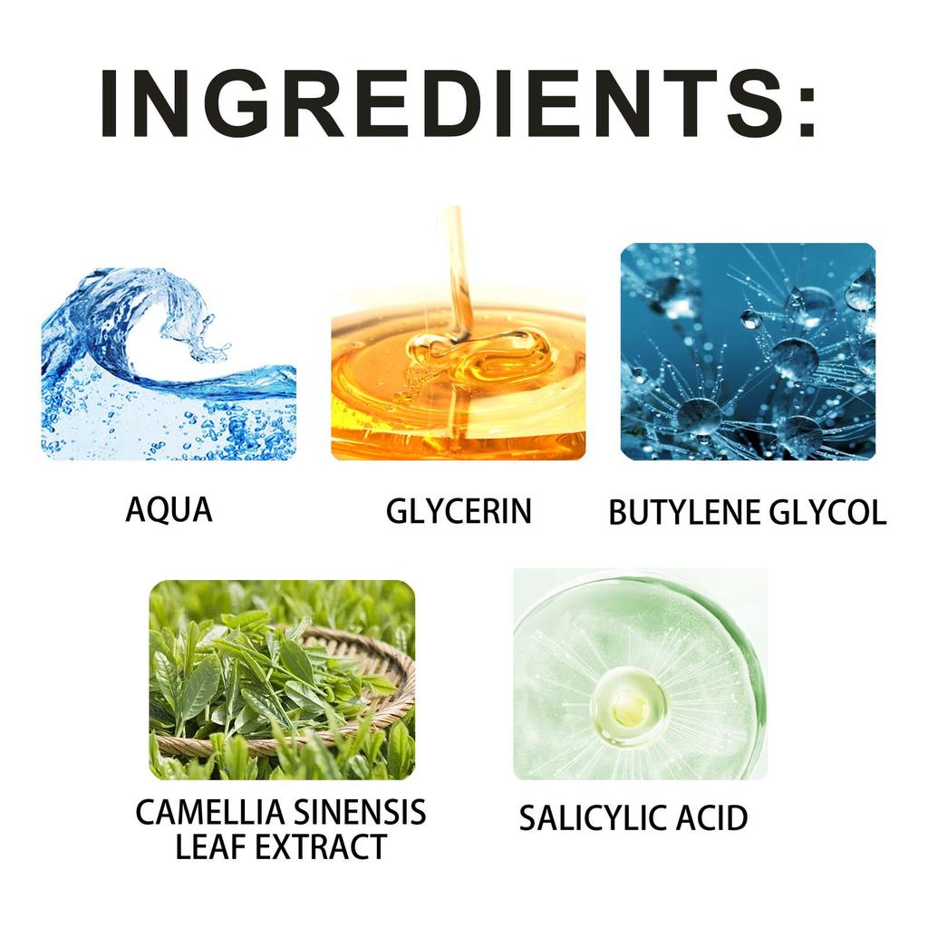 Hoygi Salicylic Acid Acne Clear Serum, Improves Acne, Fades Acne Marks, Tightens Pores, and Moisturizes the Skin. Suitable for the Face, 118ml