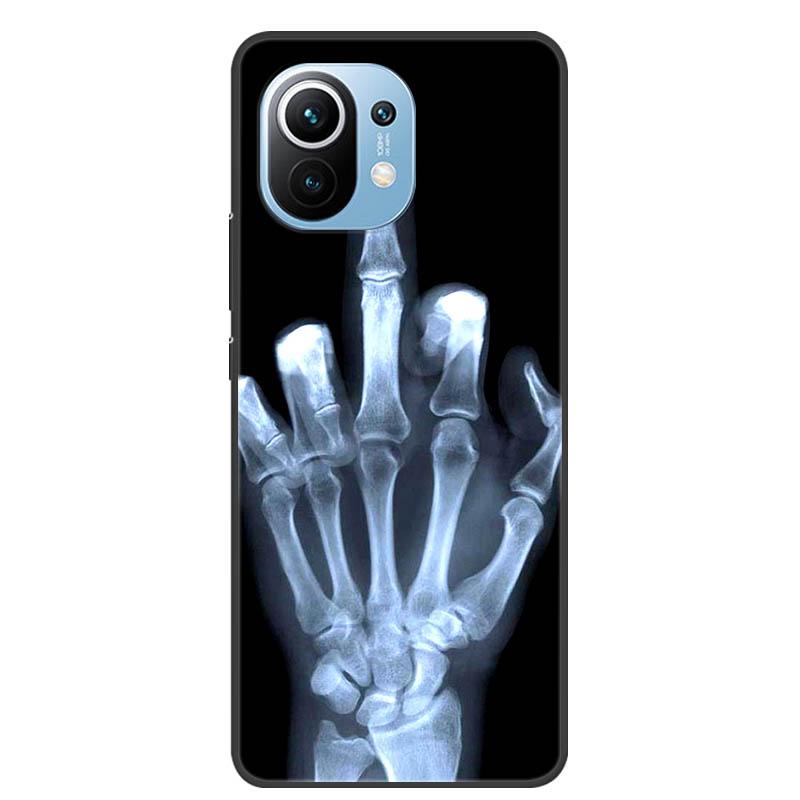 For Xiaomi 11 Lite 5G NE Case Protective Silicone TPU Phone Cases for Xiaomi Mi 11 Lite 5G Shockproof Covers 11Lite Soft Fundas