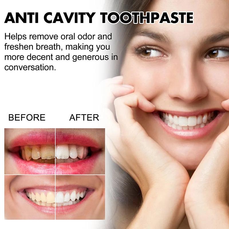 Blanchir les dents réparation dentifrice carie dentaire enlever la Plaque soulager la parodontite mal de dents élimination rafraîchit l'haleine soins des dents