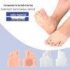 Silikon-Hallux-Valgus- und Zehentrenner mit Stoßdämpfer