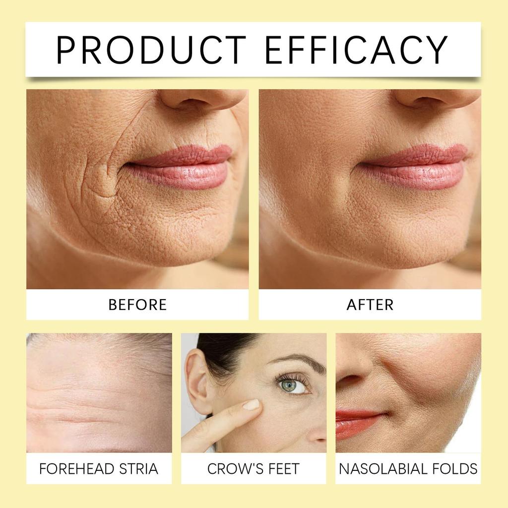 West&Month 24K Gold Anti-Wrinkle Serum 30ml Hyaluronic Acid Serum Reduces Wrinkles, Firms and Tightens Nourishes and Hydrates Facial Skin