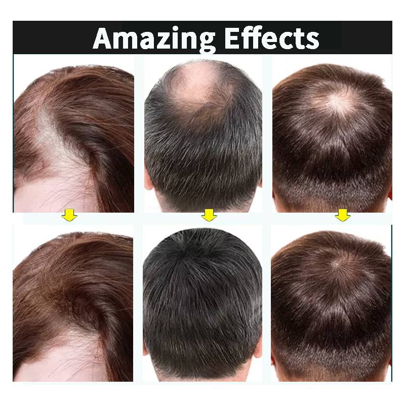 Dimollaure Huile de Croissance Capillaire Améliorer la Chute de Cheveux Croissance Cheveux Épais Essence Soin du Cuir Chevelu