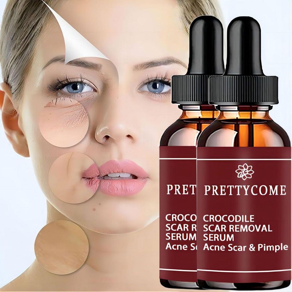 Scar removing essence repairing skin whitening brightening essential oil moisturizing and hydrating fluid