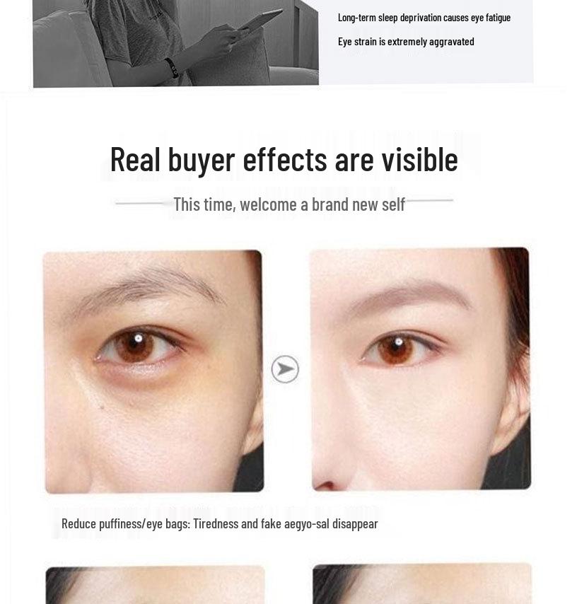 Anti-Wrinkle Eye Cream: Reduces Fine Lines, Bags, Tear Troughs & Crow's Feet; Moisturizes, Fades Dark Circles, Lifts & Firms