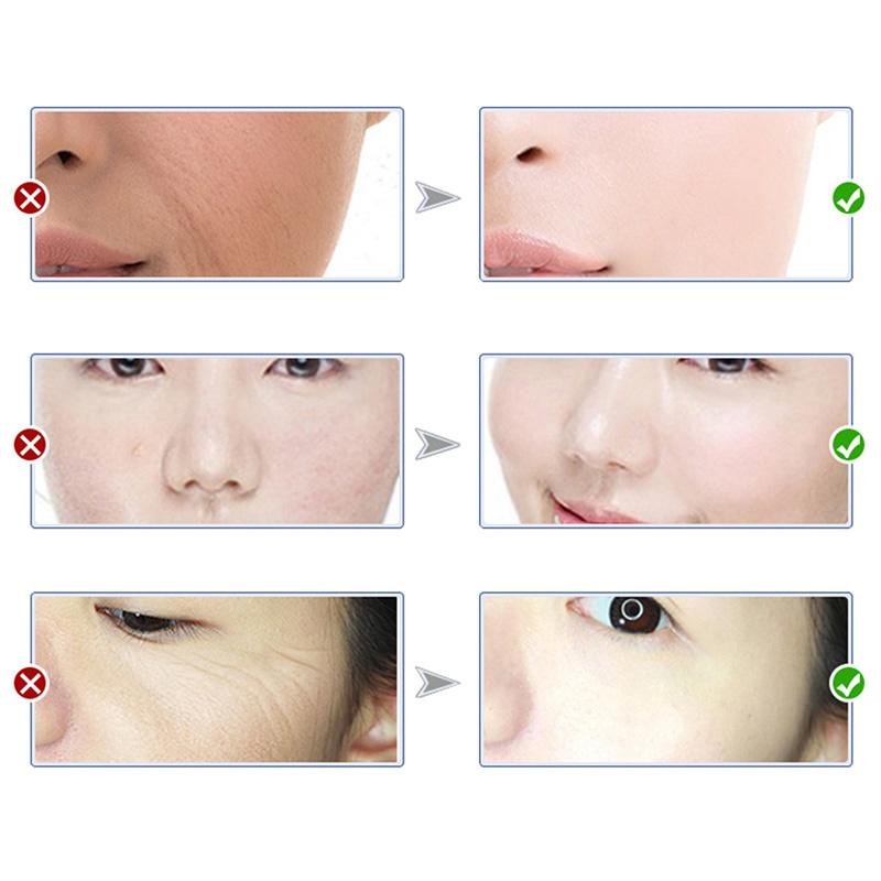 1pc Blueberry Essence Acid Skin Care Facial Liquid Whitening Moisturizing Shrink Pores Cream